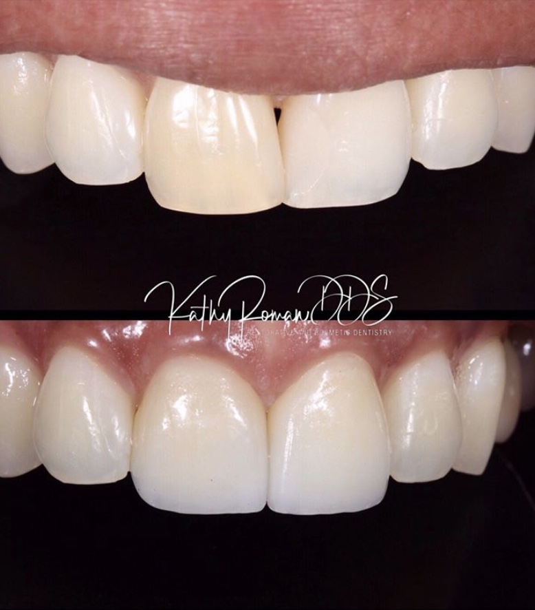 Dentist in Pembroke Pines