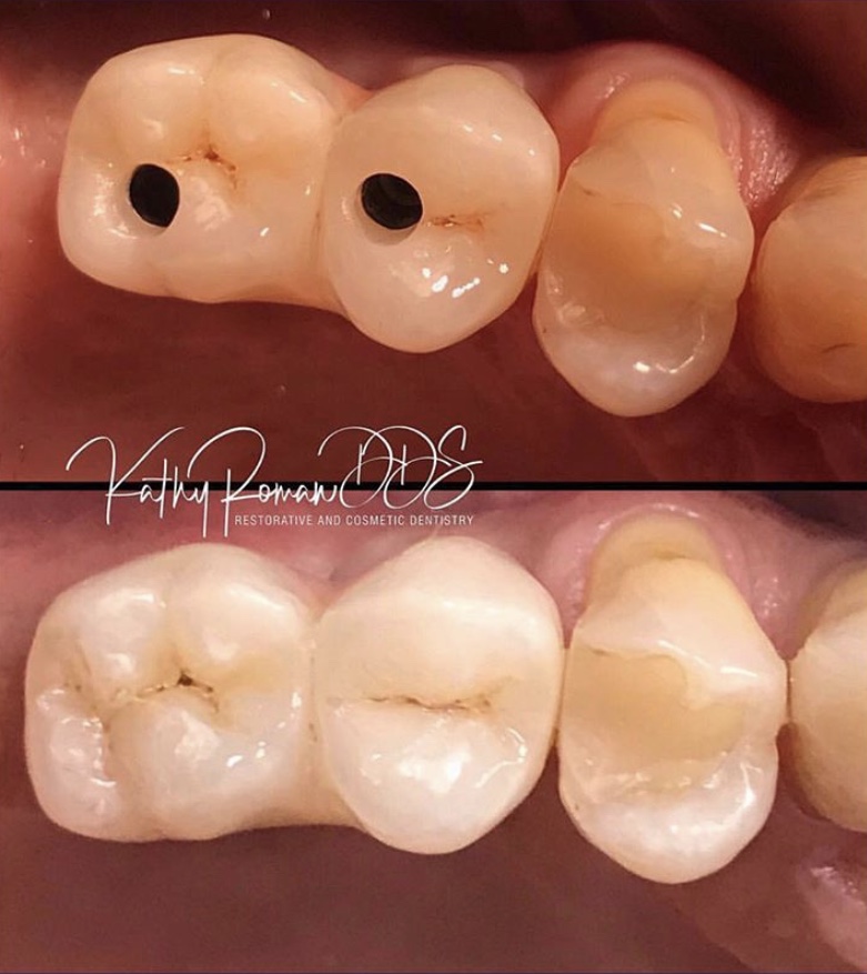 Dentist in Pembroke Pines