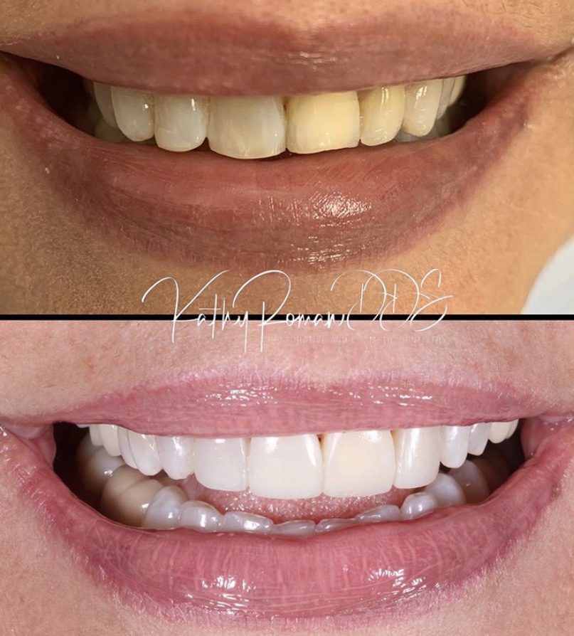 Dentist in Pembroke Pines