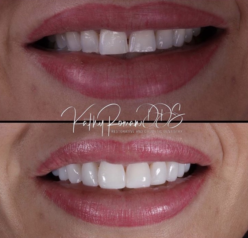 Dentist in Pembroke Pines