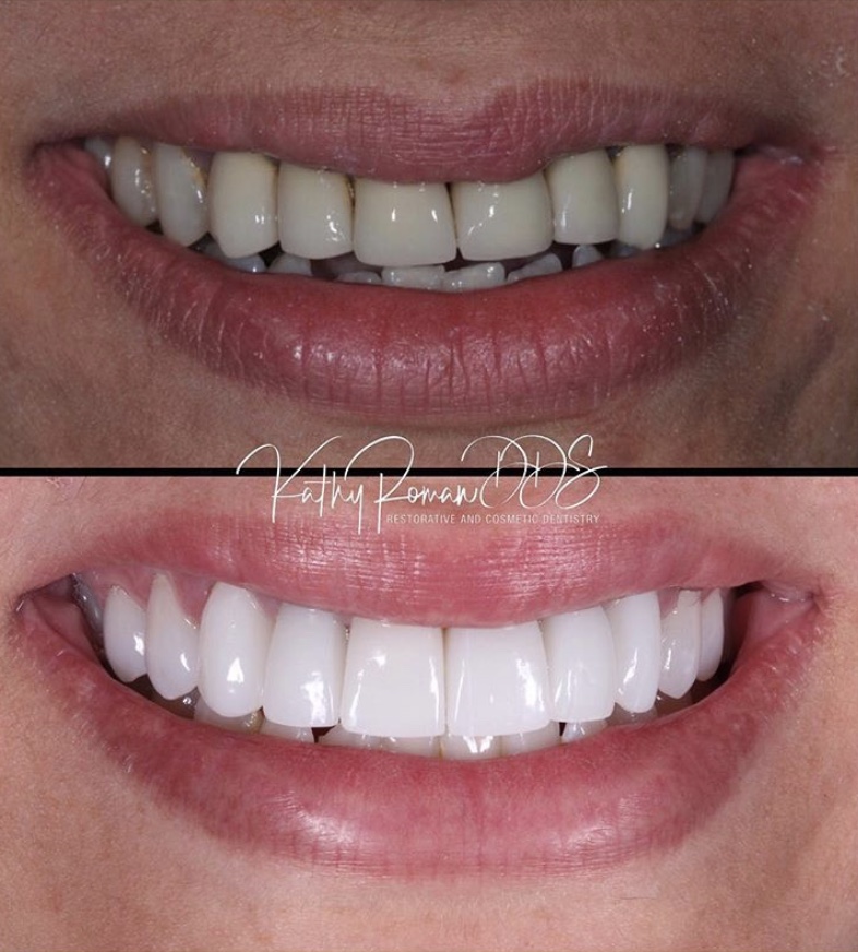 Dentist in Pembroke Pines