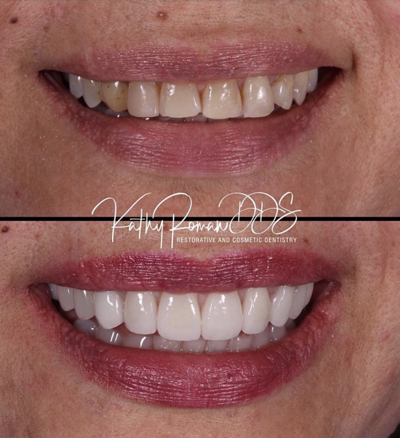 Dentist in Pembroke Pines