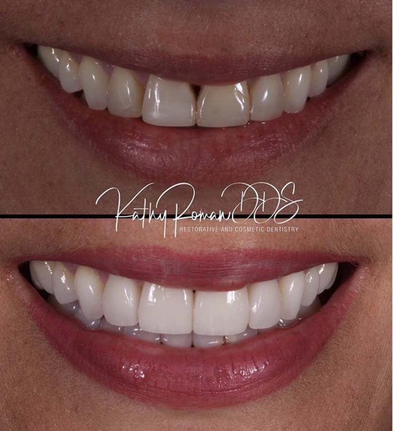 Dentist in Pembroke Pines