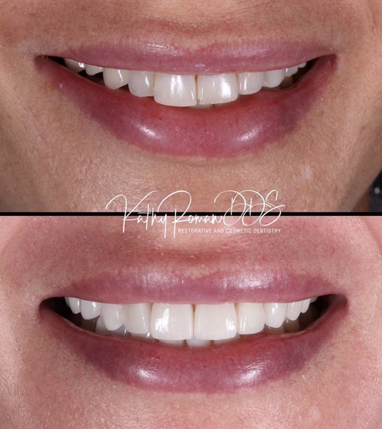 Dentist in Pembroke Pines