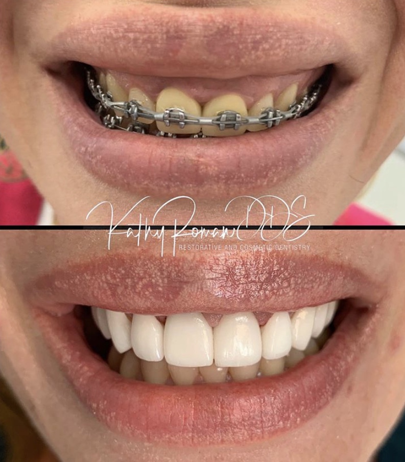 Dentist in Pembroke Pines