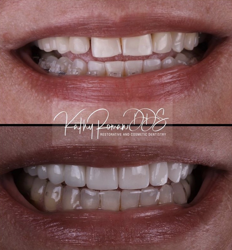 Dentist in Pembroke Pines